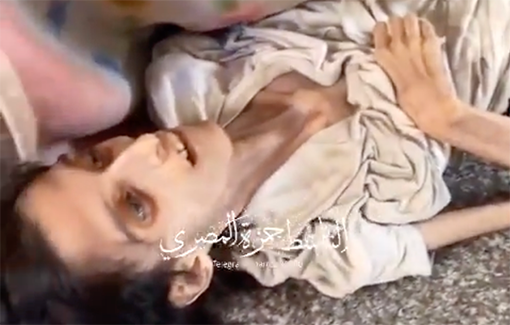 Thumbnail preview image for the video titled: IDF's starvation policy kills yet another child