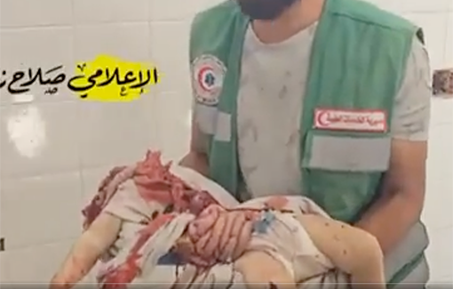 Thumbnail preview image for the video titled: IDF completely mutilates baby in Khadij school strikes