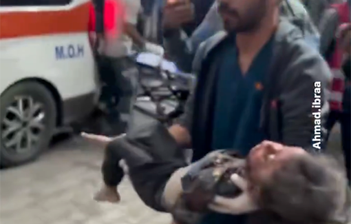 Thumbnail preview image for the video titled: Carrying a wounded girl to Al Kuwait Hospital after the house she was in was bombed by Israel