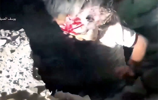 Thumbnail preview image for the video titled: A girl from the Al-Fayyumi family pulled alive from the rubble of her home, asks for her mother (but Israel killed her mother)