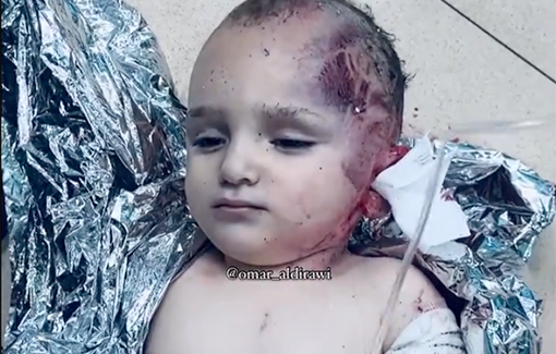 Thumbnail preview image for the video titled: Infant survivor of Bureij bombing shivers on hospital floor