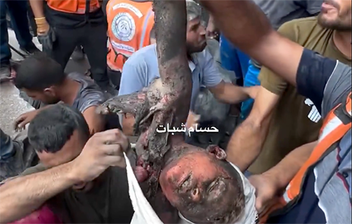 Thumbnail preview image for the video titled: Body parts of children after the IDF attacked Jabalia camp