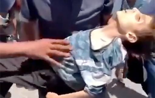 Thumbnail preview image for the video titled: A 9 year old child, Mohammed Kalloub, died today after being starved to death by the Israeli siege against the people of Gaza