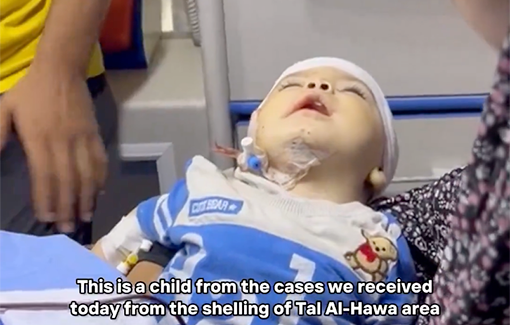 Thumbnail preview image for the video titled: A 7 months/o suffered a brain hemorrhage due to the Israeli bombing