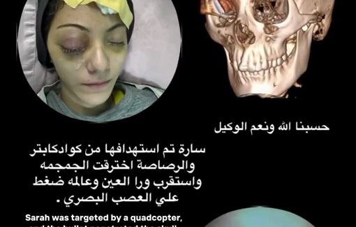 Thumbnail image of a video tagged with Dr. Mohamed Tawfik