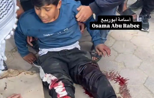 Thumbnail preview image for the video titled: Child injured in Israeli bombing of Al-Hurriya school