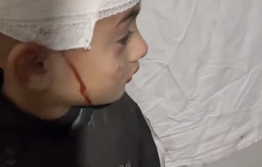 Thumbnail preview image for the video titled: Childen injured in Israeli night bombing of Al-Tabi'in School