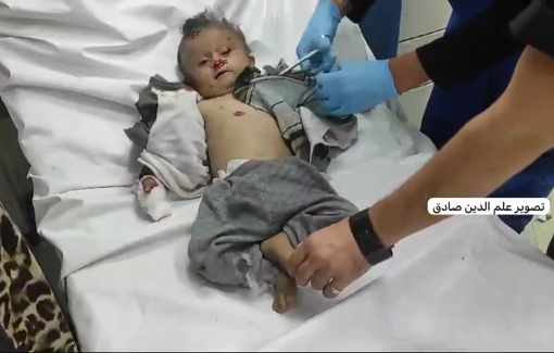 Thumbnail preview image for the video titled: Infant injured in Israeli airstrike on tents in the "safe zone"