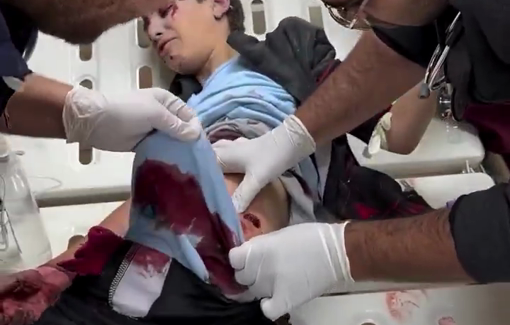 Thumbnail preview image for the video titled: Child among 5 injured in Israeli strike on Abu Qasmiya family apartment