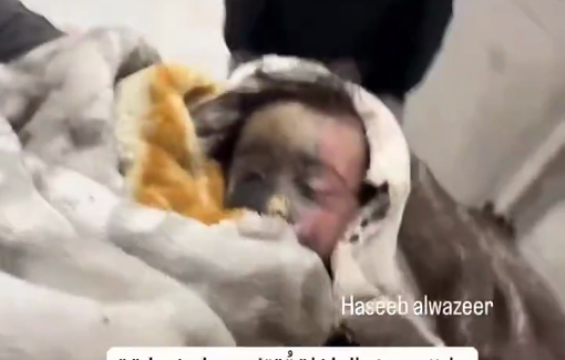 Thumbnail preview image for the video titled: Infant died with face burns after Israel bombed displacement camp in Al-Mawasi