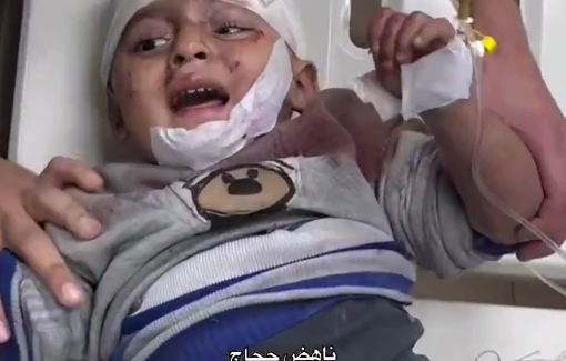 Thumbnail preview image for the video titled: Children injured in Israeli bombing of Al-Nadi family house