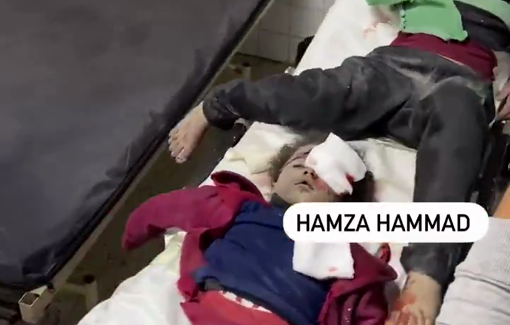 Thumbnail preview image for the video titled: Children injured in midnight Israeli massacre on Al-Jalaa Street