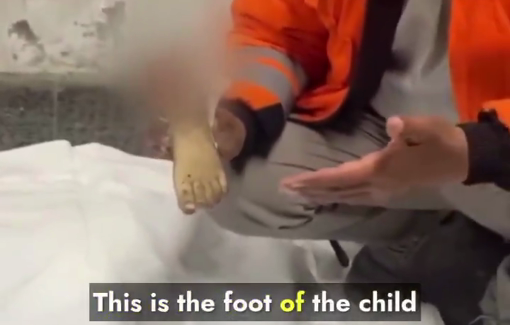 Thumbnail preview image for the video titled: Severed foot of a child, among many, killed in Israeli bombing of Tabatibi family