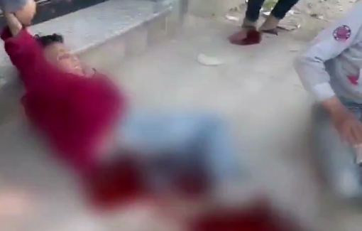 Thumbnail preview image for the video titled: Child bleeding and others injured in Israeli strike on a group of people