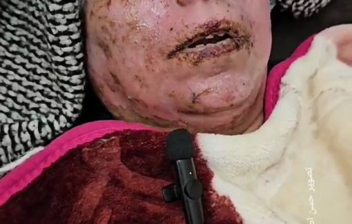 Thumbnail preview image for the video titled: Injured woman recounts a double Israeli strike on her home