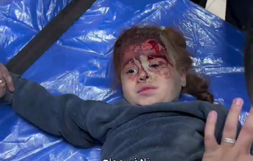 Thumbnail preview image for the video titled: Children injured in Israeli bombing of the Abu Samra family house