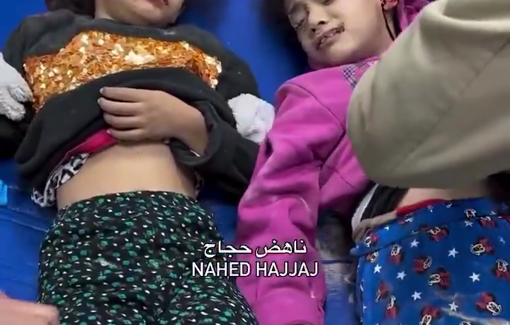 Thumbnail preview image for the video titled: Children injured in Israeli bombing of their home in Maghazi