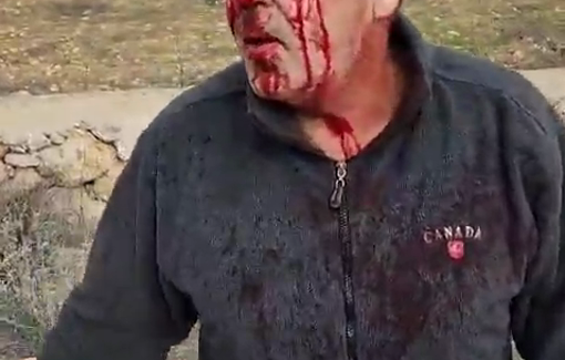 Thumbnail preview image for the video titled: Israeli Settler Attack on Palestinian Farmers in Silwad, West Bank: 4 Injured