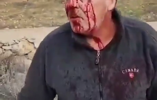 Thumbnail preview image for the video titled: Israeli settlers violently attacked three Palestinian farmers, injured them, and damaged cars in Silwad