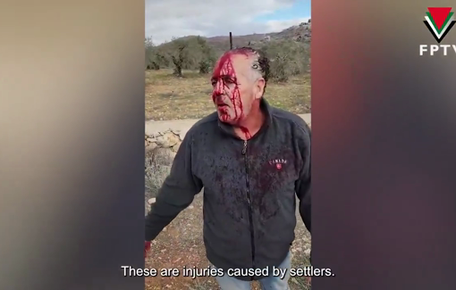 Thumbnail preview image for the video titled: 4 Palestinian farmers injured by Israeli settlers in the town of Silwad