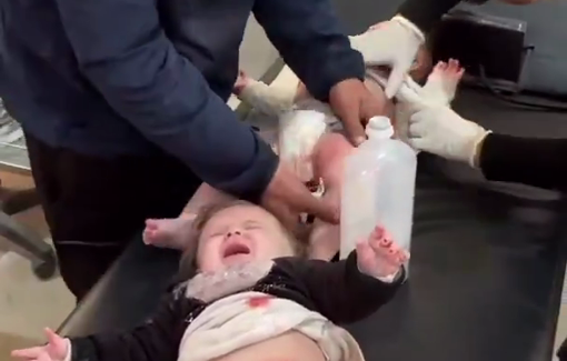 Thumbnail preview image for the video titled: Infants injured by Israeli artillery shelling on Nuseirat