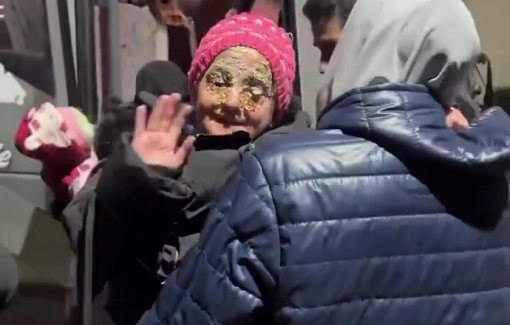 Thumbnail preview image for the video titled: Several children and patients from Gaza are evacuated for treatment in the UAE