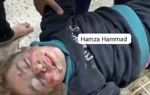 Thumbnail preview image for the video titled: Children wounded in Israeli bombing of homes in Jabalia al-Balad