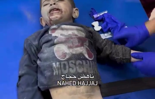 Thumbnail preview image for the video titled: Children injured in night Israeli bombing of the Abu Labda family