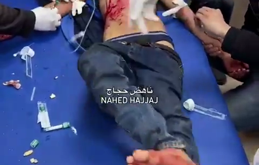 Thumbnail preview image for the video titled: Casualties taken to hospital after an Israeli strike on Abu Helo school