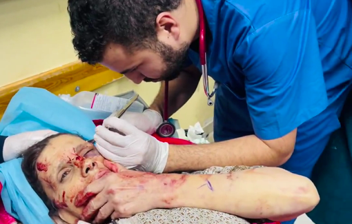 Thumbnail preview image for the video titled: Palestinian doctor stitched the wounds of a 63 y/o woman without any anesthetic