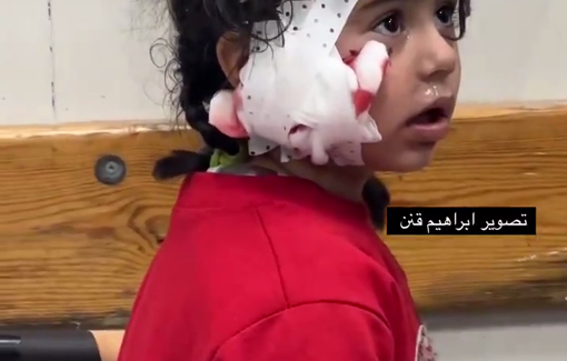 Thumbnail preview image for the video titled: Child injured in Israeli night airstrike on a displacement tent