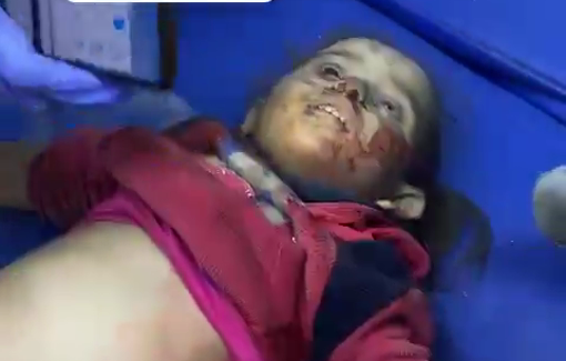 Thumbnail preview image for the video titled: Little girl killed in the bombing of her home in Gaza City