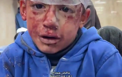 Thumbnail preview image for the video titled: Terrified child, injured and orphaned by Israeli bombing of his home