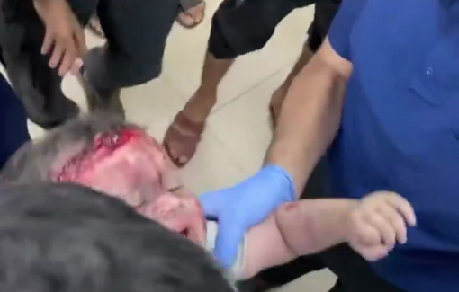 Thumbnail preview image for the video titled: Baby girl cries in pain, injured in the bombing of her family’s home