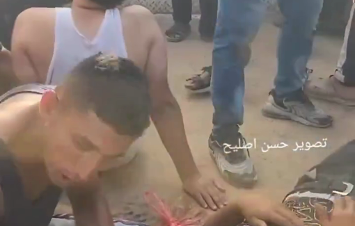 Thumbnail preview image for the video titled: Massive arrival of wounded after Israeli bombings in Khan Younis leaving at least 60 dead