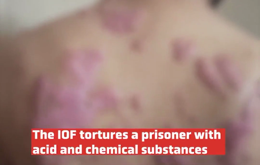 Thumbnail preview image for the video titled: Tortured by Israelis with chemicals and constant beatings