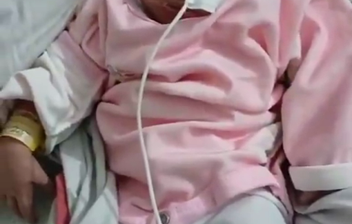 Thumbnail preview image for the video titled: Baby born without a brain in Gaza