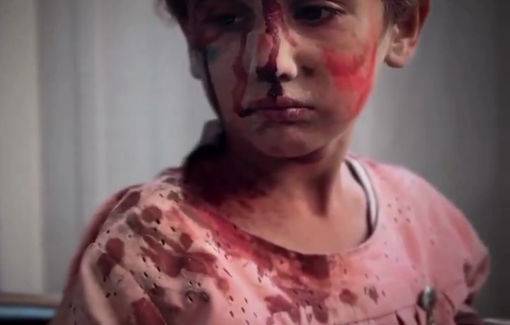 Thumbnail preview image for the video titled: Girl injured in Hassan Salama bombing stunned by the horror