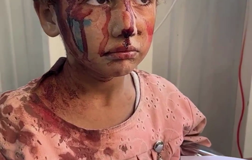 Thumbnail preview image for the video titled: Children injured in massacre at Hassan Salama and Al-Nasr schools