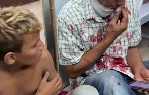 Thumbnail preview image for the video titled: Dead and injured taken to Al Aqsa hospital in Central Gaza