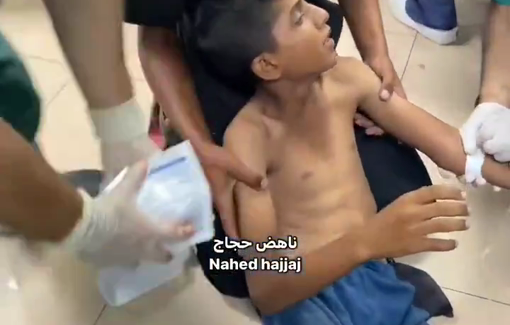 Thumbnail preview image for the video titled: Injured children at Al Aqsa hospital following strikes in Deir al-Balah