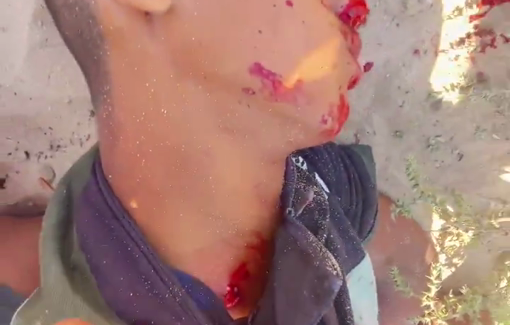 Thumbnail preview image for the video titled: Boy was shot dead in the neck by Israeli forces while seeking aid at the Rafah GHF site