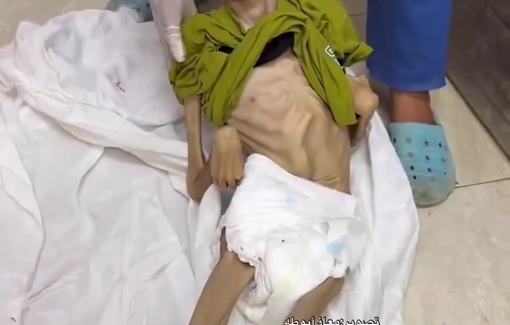Thumbnail preview image for the video titled: 29 year-old Ayoub Abu Hussein killed by Israel's starvation policy