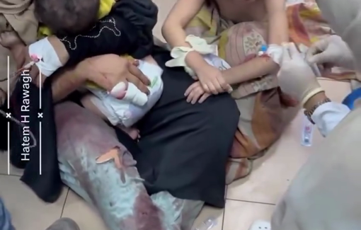 Thumbnail preview image for the video titled: Mother in pain soothes her children injured in Bureij strikes