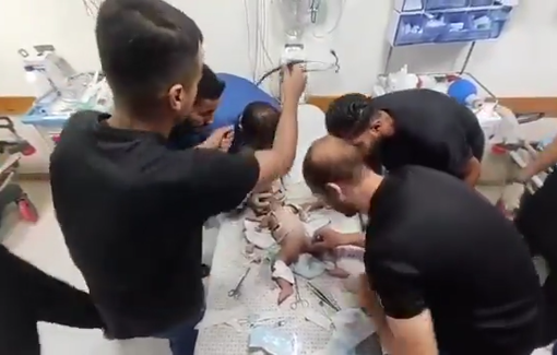 Thumbnail preview image for the video titled: Baby injured in bombing of Hawila family home in Jabalia