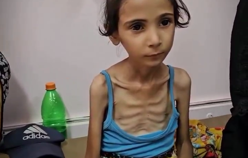Thumbnail preview image for the video titled: Under a suffocating Israeli siege, many now suffer from severe hunger and malnutrition