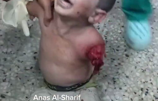 Thumbnail preview image for the video titled: A displaced child sheltering in Al-Qahira School lost his arm in an Israeli airstrike on