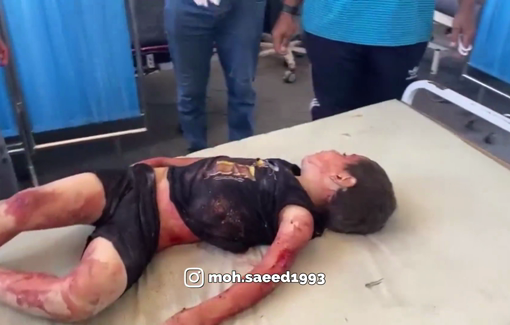 Thumbnail preview image for the video titled: Little boy found lying injured after Al-Tabi'in school bombing