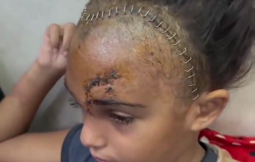 Thumbnail preview image for the video titled: Appeal: 7y/o Sila Hosso sustained serious injuries in the Khadija school massacre