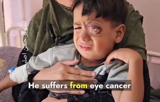 Thumbnail preview image for the video titled: Appeal: boy suffers from advanced eye cancer